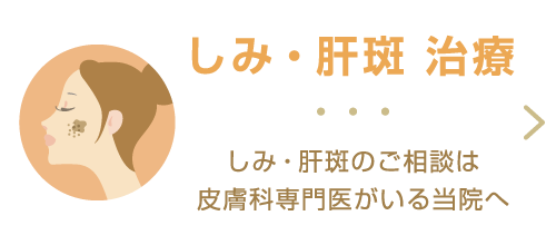 しみ・肝斑 治療 しみ・肝斑のご相談は皮膚科専門医がいる当院へ。